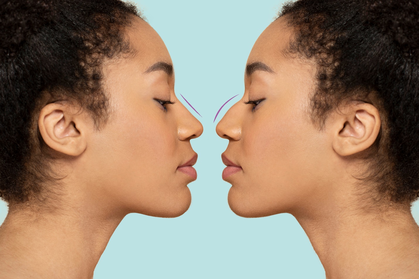 13 astuces pour affiner le nez sans se faire opérer